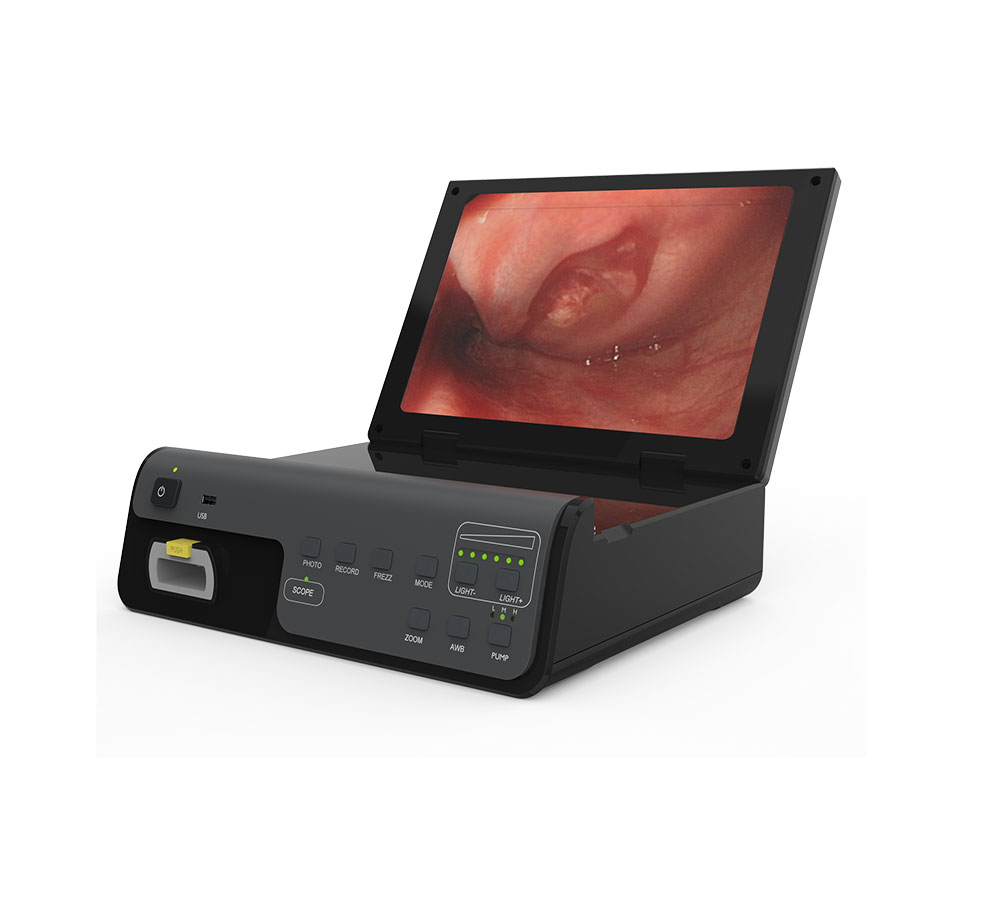 Digital Gastroscope