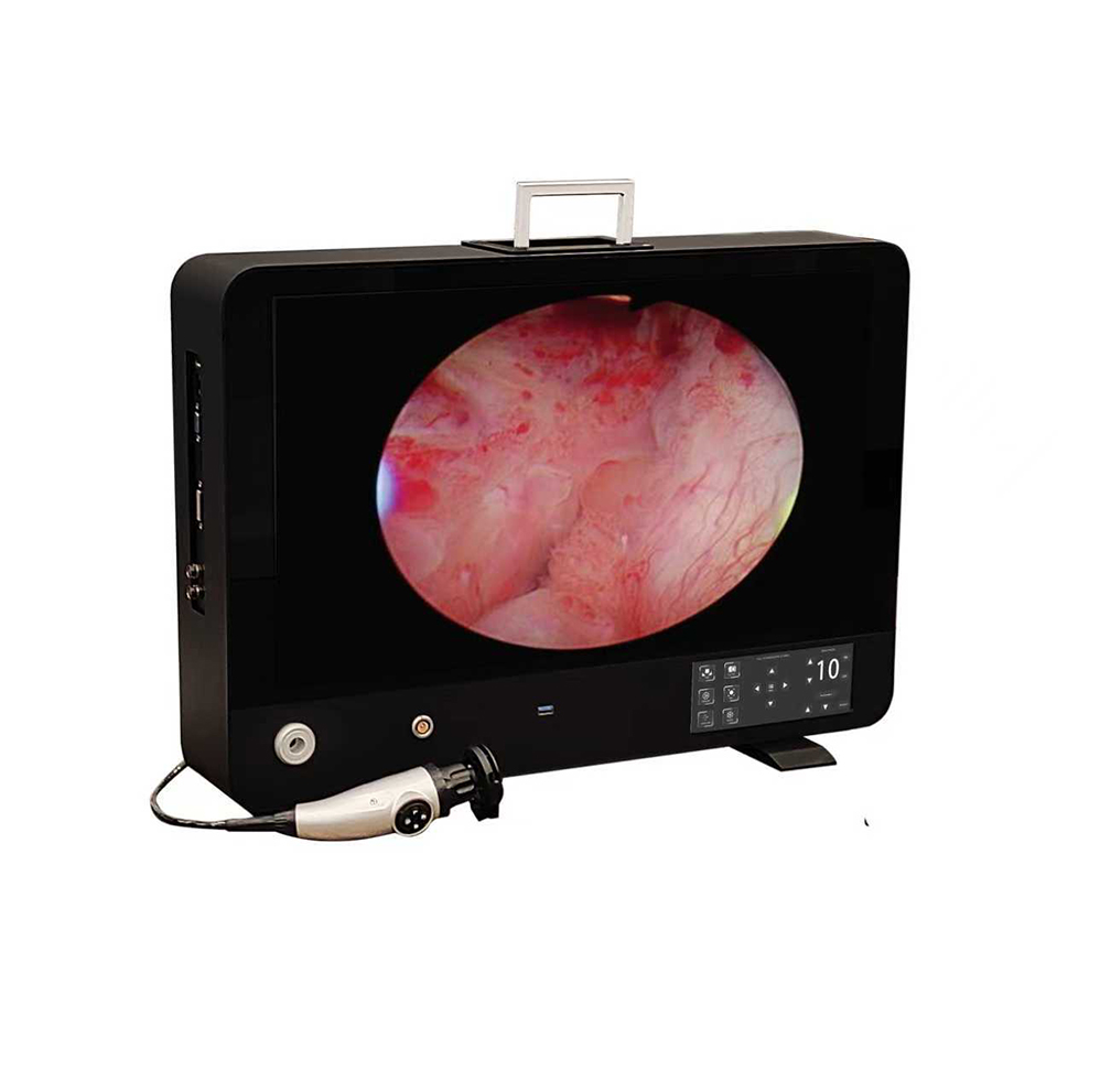 All in One Medical Endoscope Camera（Black Aluminum Alloy Tempered Glass）