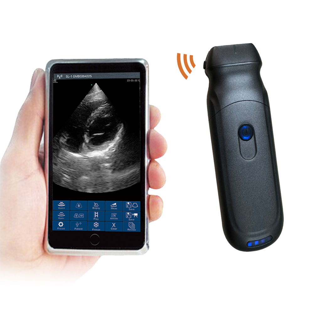Ultrasound Scanner RK-6CPL