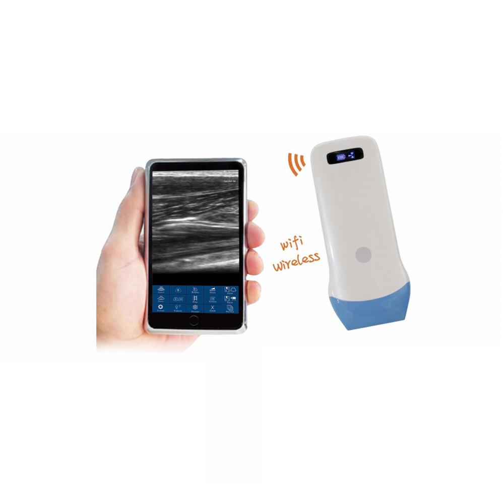 Ultrasound Scanner RK-5L(UProbe)